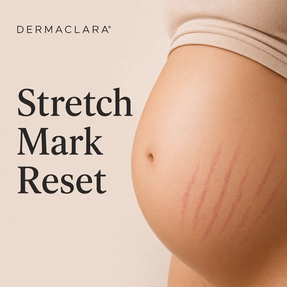 Dermaclara ChatGPT ad — The Stretch Mark Reset