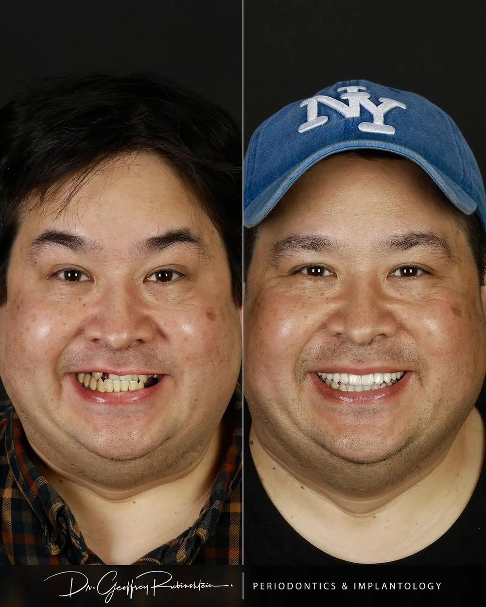 Rubinshtein Aesthetics - New York ChatGPT ad — The Smile Trusted by Celebrities in Dental & Vision Care